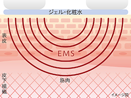 1_1-42 イメージ:EMS